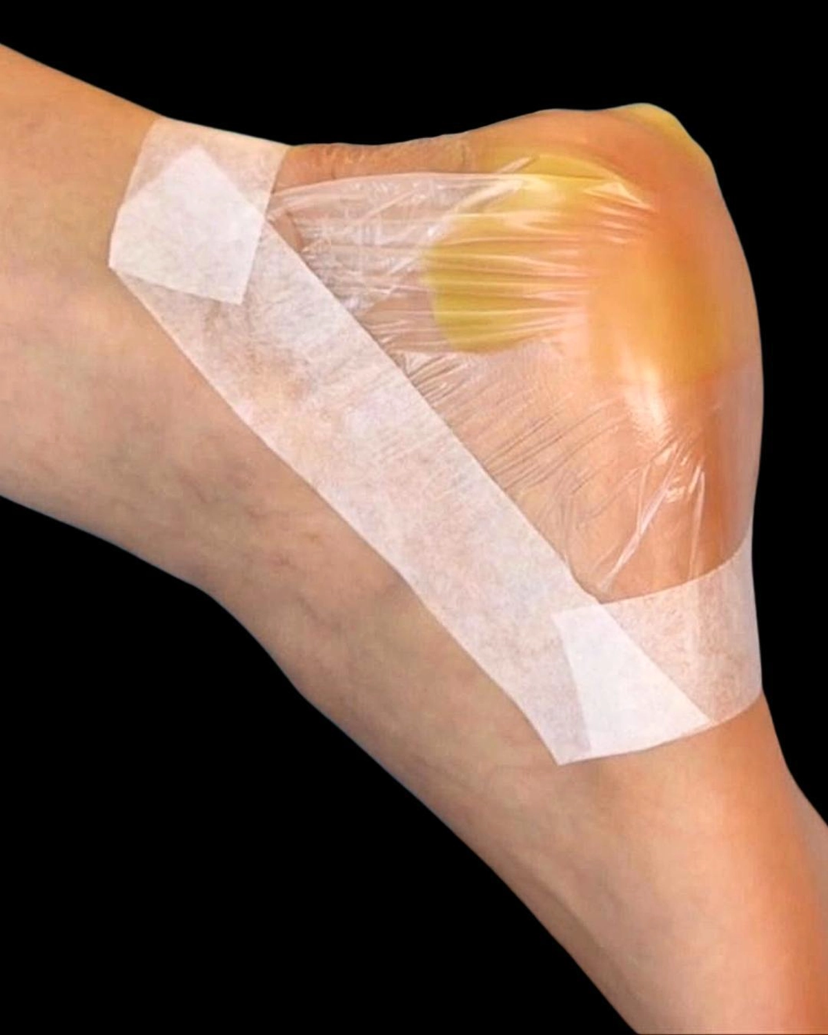  Helena Plöckl – Fußwerk - Fersenpflege